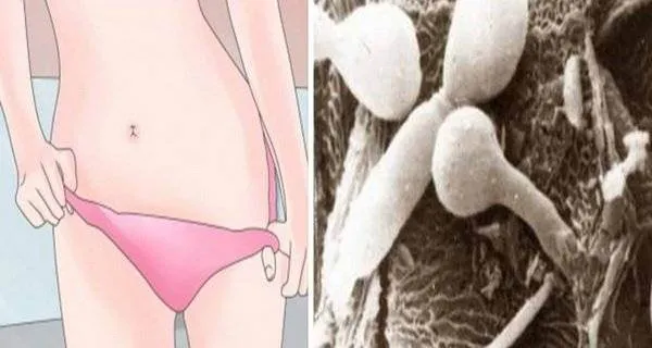 Lenjeria tanga, pericol de imbolnavire! Medicii avertizeaza: un real factor de risc pentru aparitia cancerului
