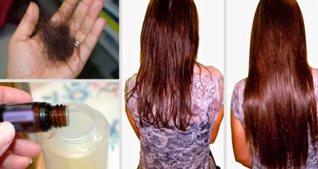 5 probleme pe care le poti avea cu parul si cum sa scapi de ele