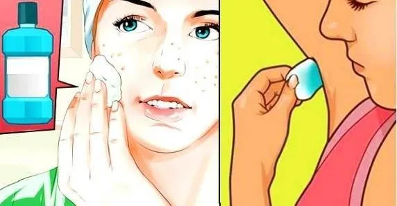 Moduri de utilizare ale apei de gura pe care nu le banuiai