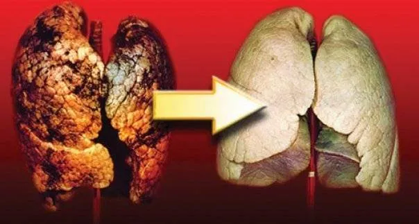 Esti fumator? Aceasta reteta te va ajuta sa-ti cureti plamanii