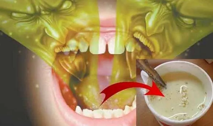 Preparatul minune care te scapa de respiratia urat mirositoare in doar 5 minute