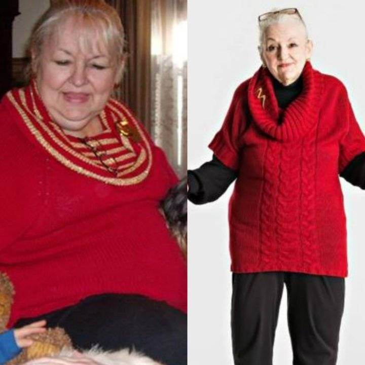 Credea ca este putin plinuta, insa avea o tumoare de 63 de kilograme! A descoperit dupa 16 ani