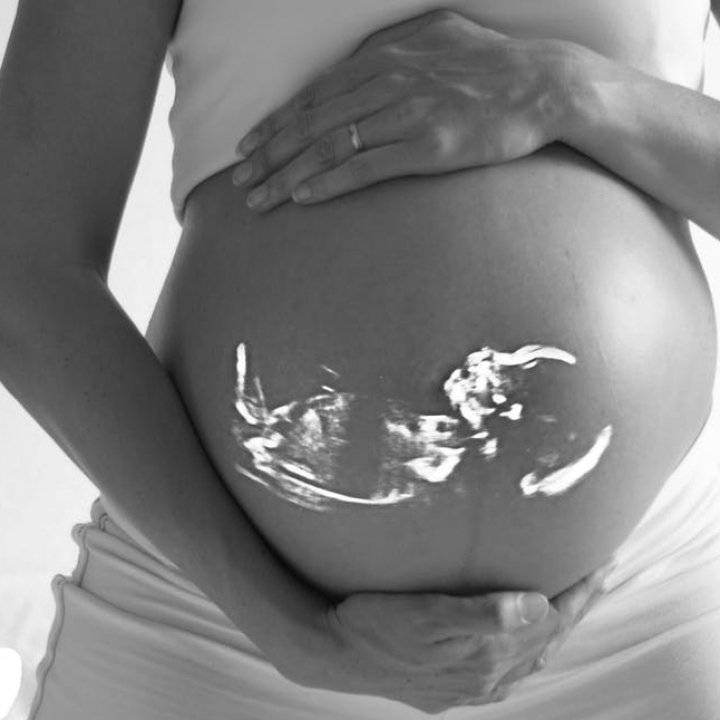 Gravidele NU trebuie sa consume zahar pe timpul sarcinii! Ce pot pati bebelusii