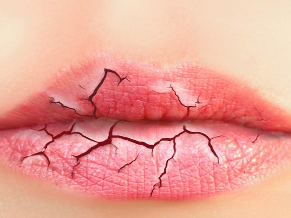 Ai buzele uscate? Iata de ce!