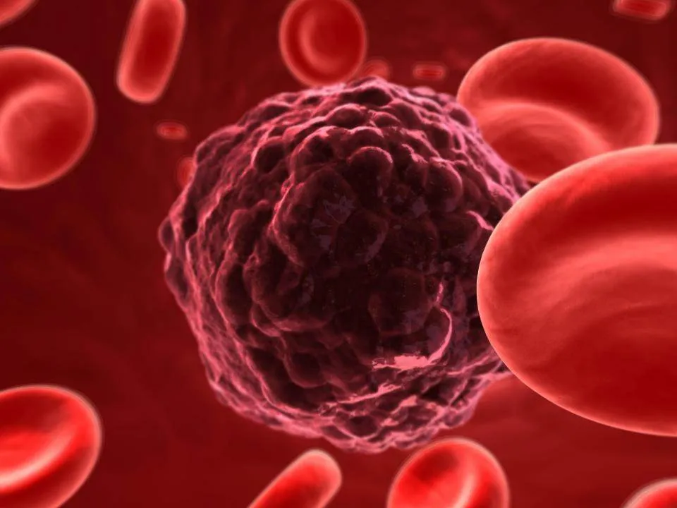 Metode simple pentru a nu avea cancer