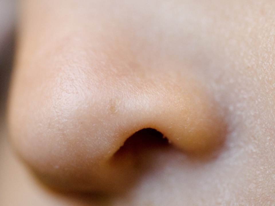 Sfaturi pentru eliminarea congestiei nazale