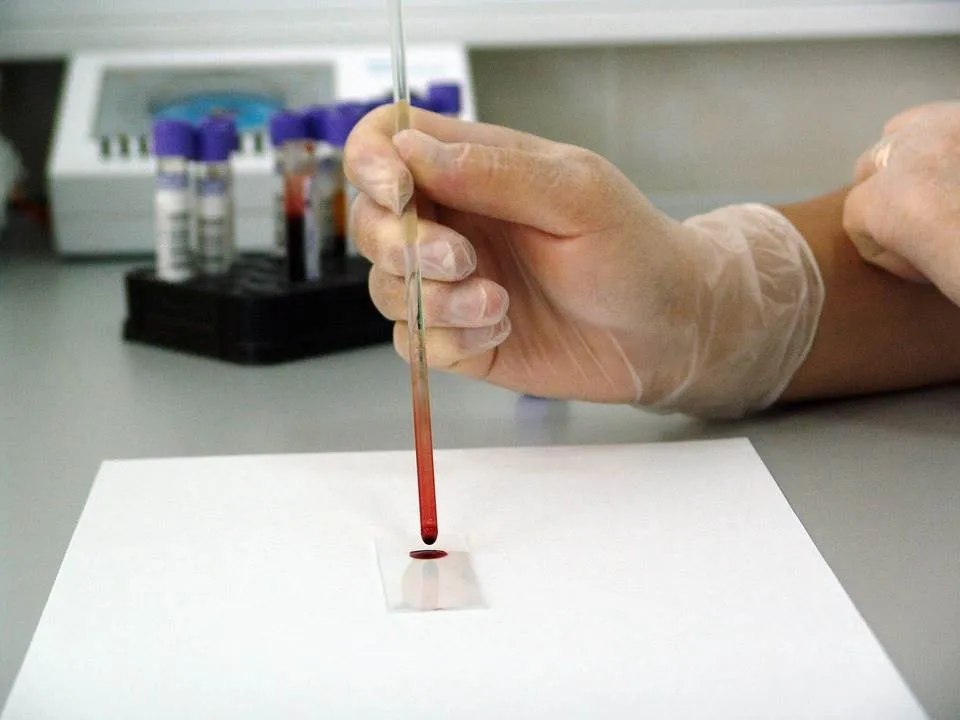 Hepatita B: cauze si simptome