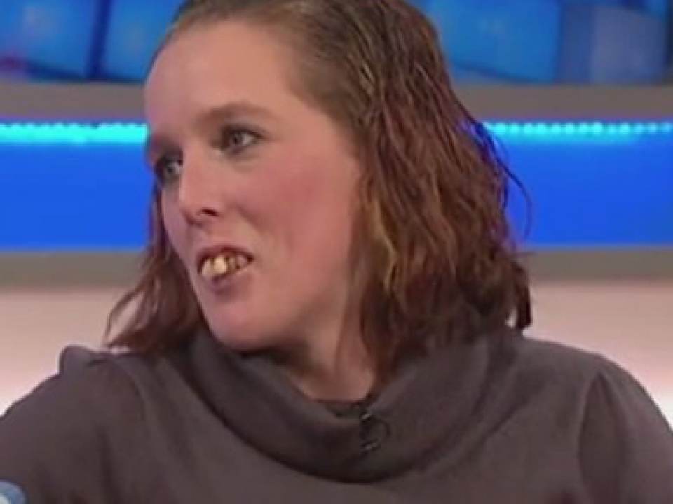 A fost hartuita din cauza dintilor! Dar a investit 11.000 de euro in noua dantura