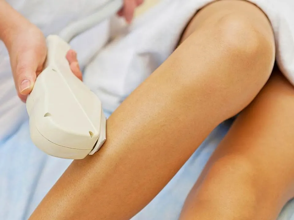 Epilarea definitiva poate duce la cancer? Ce spun specialistii