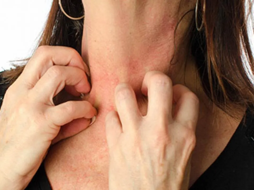 Alimente de mancat atunci cand suferi de eczema