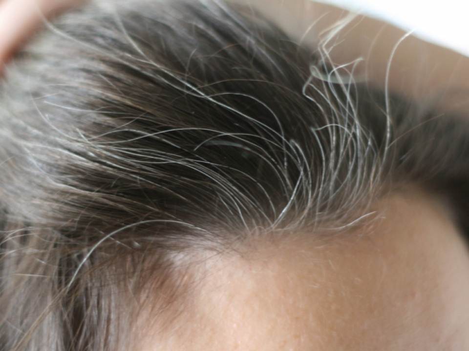 Adevarata cauza a albirii premature a parului