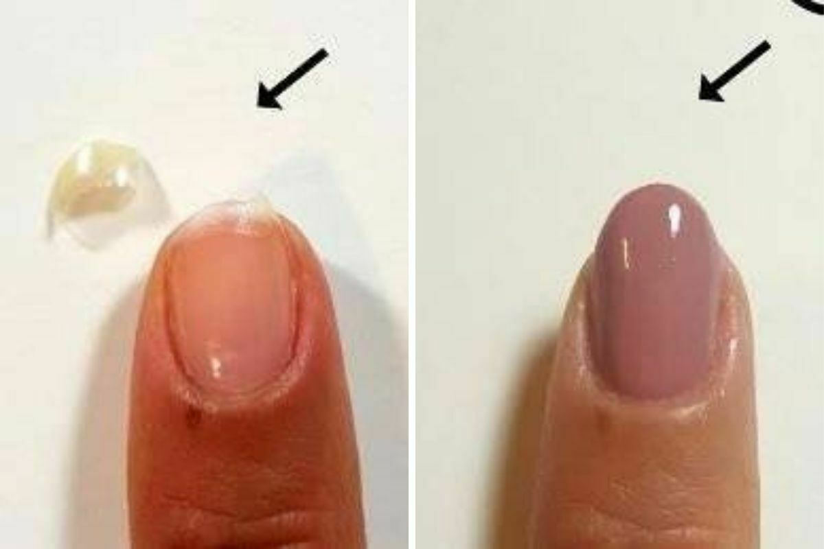 Ti s-a rupt o unghie, chiar inainte de un eveniment important?! Nu dispera! Iata cum o poti repara