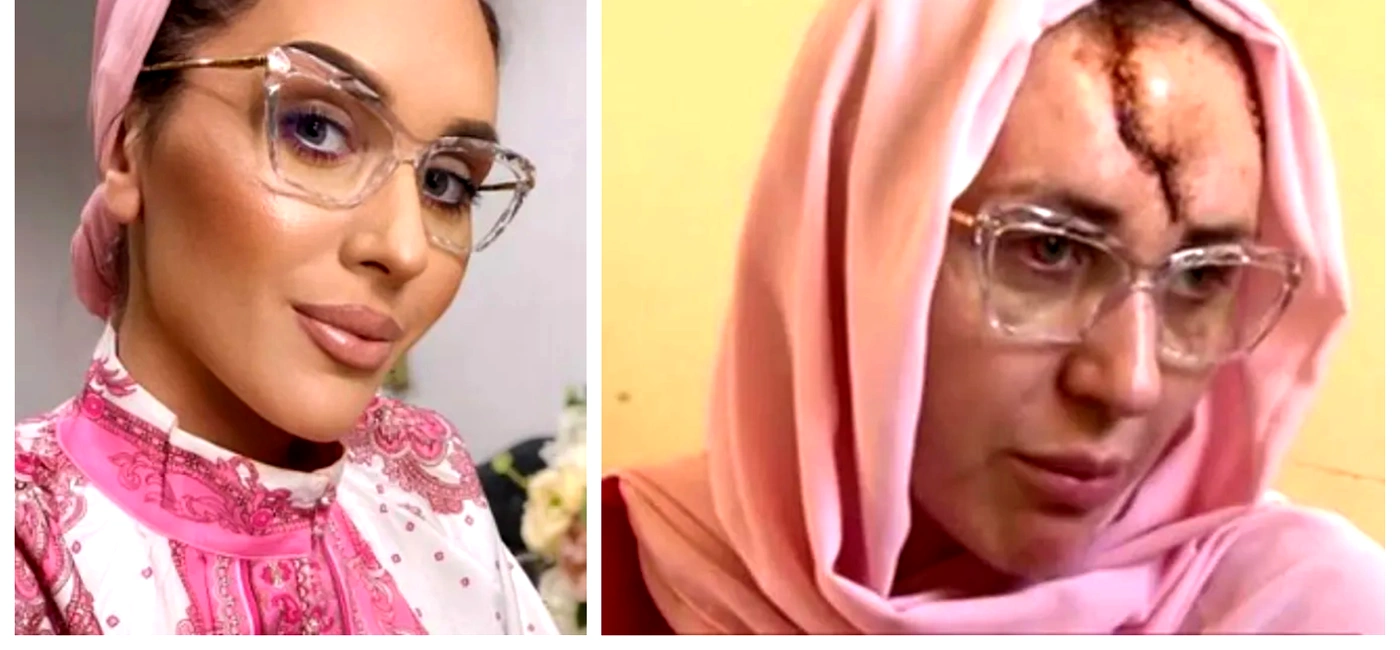 Primele imagini cu Dana Roba după ce a fost mutilată de către soțul ei cu un ciocan