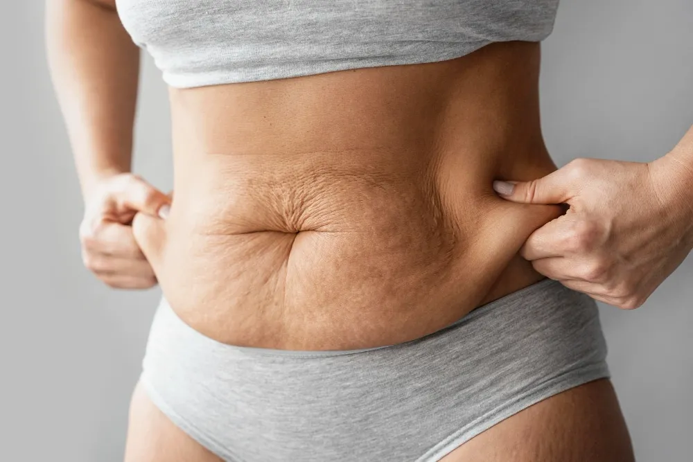 Mare descoperire! Proteina responsabilă de depozitarea grăsimii în celule a fost identificată