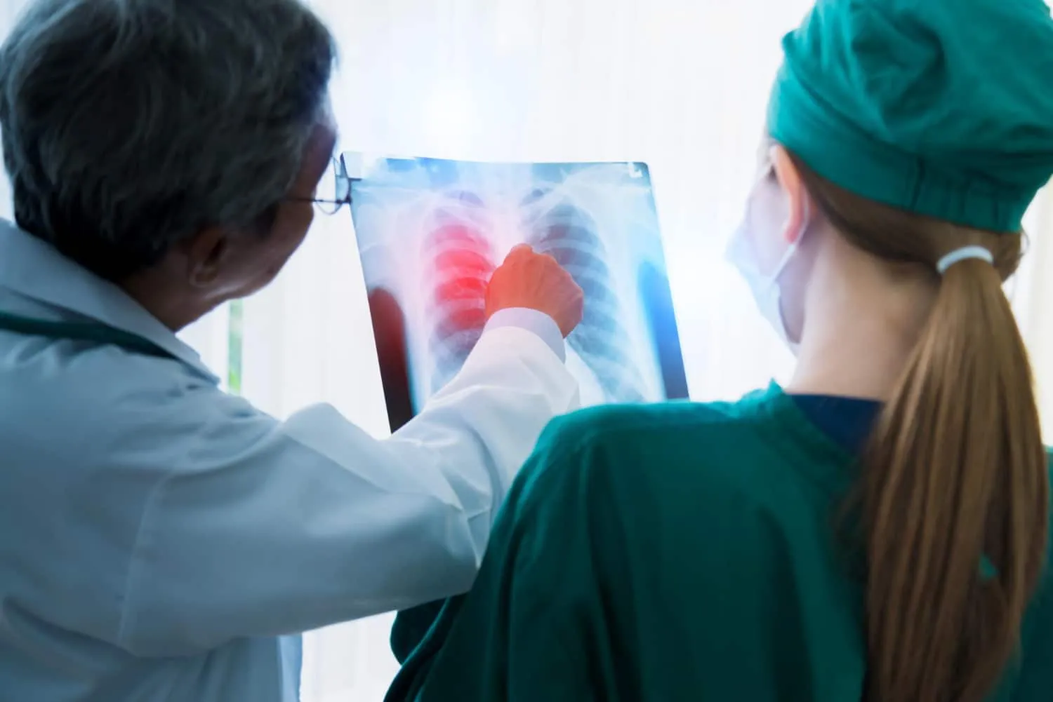 AstraZeneca eșuează în studiul LATIFY pentru cancerul pulmonar