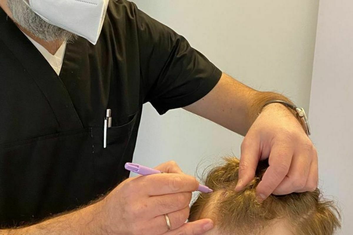 Turism medical de 20 mil. €. O clinică din București atrage pacienți din SUA pentru implant de păr