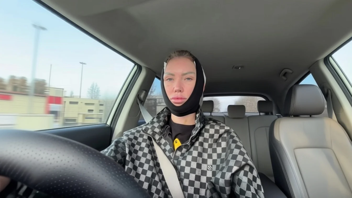 Oana Drăgușanu, sora Biancăi, cu capul bandajat după operația de mini-lifting