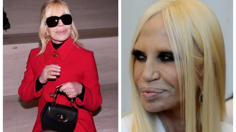 Donatella Versace uimește la 71 de ani cu un nou chip. Experții dezvăluie secretele