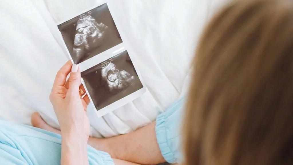 Woman holding baby scan via IVF