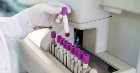 Avertisment pentru romani. Colesterolul secret care provoaca infarct si ignora dieta ta
