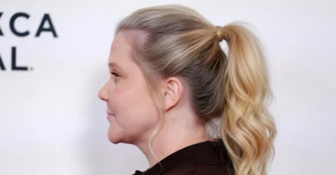Amy Schumer a recunoscut operațiile dificile prin care a slăbit la 45 de ani. Actrița a suferit de endometrioză.