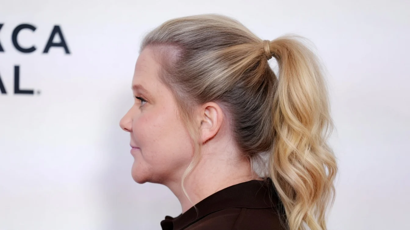 Amy Schumer a recunoscut operațiile dificile prin care a slăbit la 45 de ani. Actrița a suferit de endometrioză.