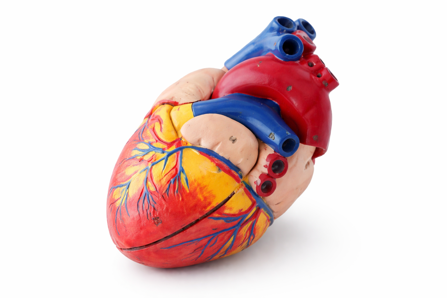 Angiografia coronariană nu înseamnă automat stent. Ce diferență esențială este față de angioplastie