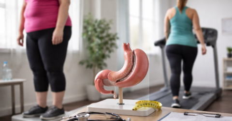 60% dintre români sunt supraponderali sau obezi. Cum arată, de fapt, drumul după gastric sleeve