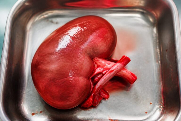 Când donezi un rinichi, vrei certitudine, nu presupuneri. Cum poate un test genetic să aducă mai multă liniște