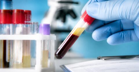 Când testosteronul mic nu cere tratament după ureche, ci analize mai atente. Ce au văzut cercetătorii la bărbați
