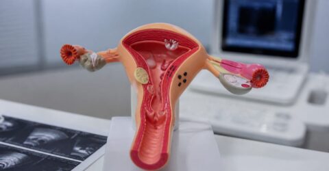 Ce câștigi din noul studiu despre adenomioză. Tratamente mai blânde care pot evita histerectomia