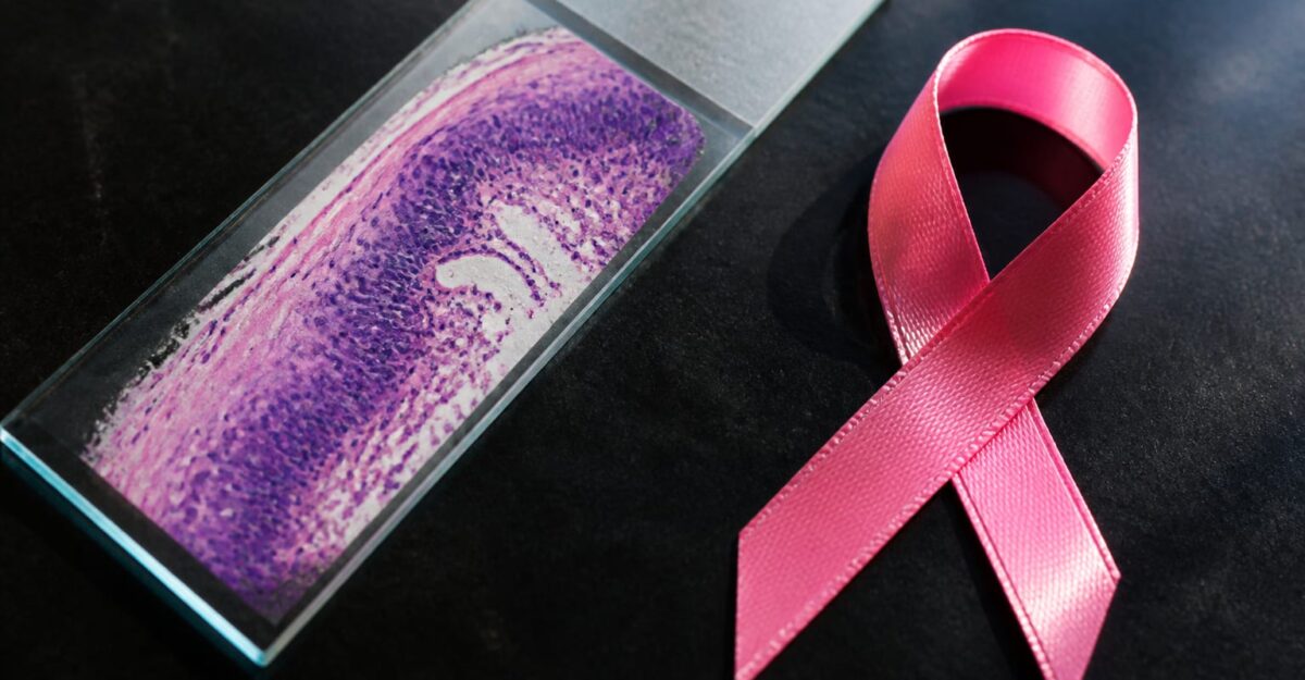 25 de femei sunt diagnosticate cu cancer de sân la fiecare caz de cancer de col uterin