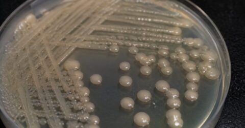 Bacteria Klebsiella pneumoniae a evoluat doi ani într-o femeie de 63 de ani