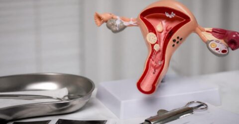 75% dintre femei trec prin asta cel puțin o dată. Cum recunoști cauza mâncărimii vaginale