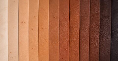 De ce o pată de la acnee nu arată roșie pe orice ten. Ce au explicat dermatologii despre pielea cu mai multă eumelanină
