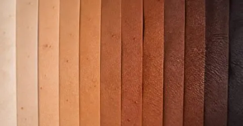 De ce o pată de la acnee nu arată roșie pe orice ten. Ce au explicat dermatologii despre pielea cu mai multă eumelanină