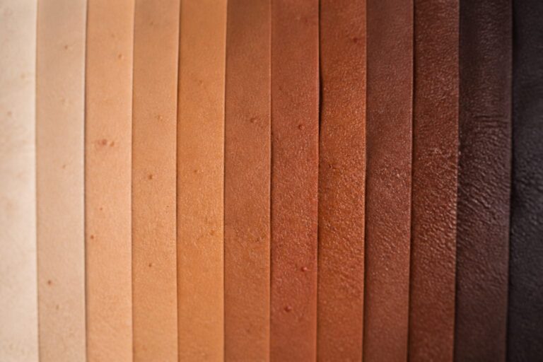 De ce o pată de la acnee nu arată roșie pe orice ten. Ce au explicat dermatologii despre pielea cu mai multă eumelanină