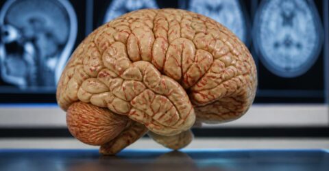 Sindromul metabolic accelerează îmbătrânirea creierului