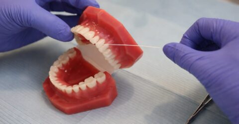 Tratamentul cu aparat dentar durează, în medie, doi ani