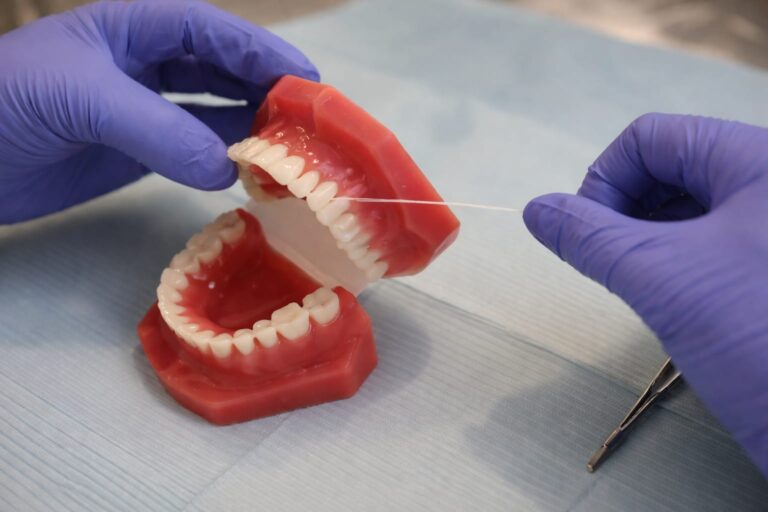 Tratamentul cu aparat dentar durează, în medie, doi ani