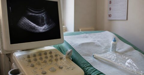 7-10 ani durează, în medie, până la diagnosticul de endometrioză. De ce nu e normal să suporți durerea la menstruație