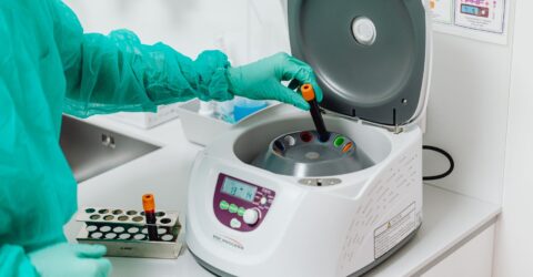 Cum se face fertilizarea in vitro și ce analize sunt necesare înainte de procedură
