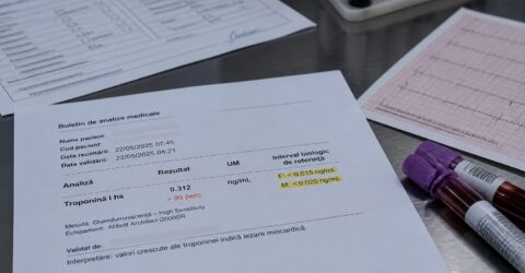De ce pot fi ratate mai ușor unele infarcturi la femei? Un nou criteriu schimbă felul în care sunt citite analizele