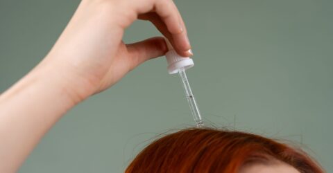 Mătreață sau scalp uscat? Cum faci diferența după scuame, mâncărime și zonele afectate