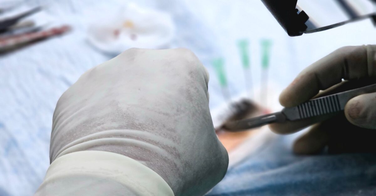 Tot mai multe femei merg în Turcia pentru transplant de păr. Procedurile pornesc de la 2.600 de dolari