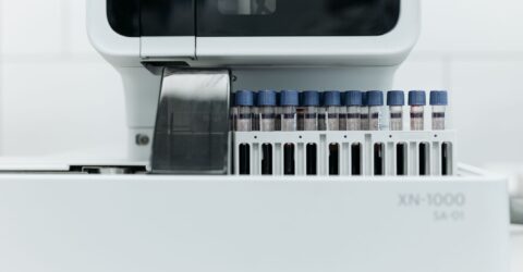 Testele de vârstă biologică estimează cum îmbătrânești. De ce poți primi rezultate diferite