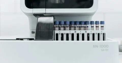 Testele de vârstă biologică estimează cum îmbătrânești. De ce poți primi rezultate diferite
